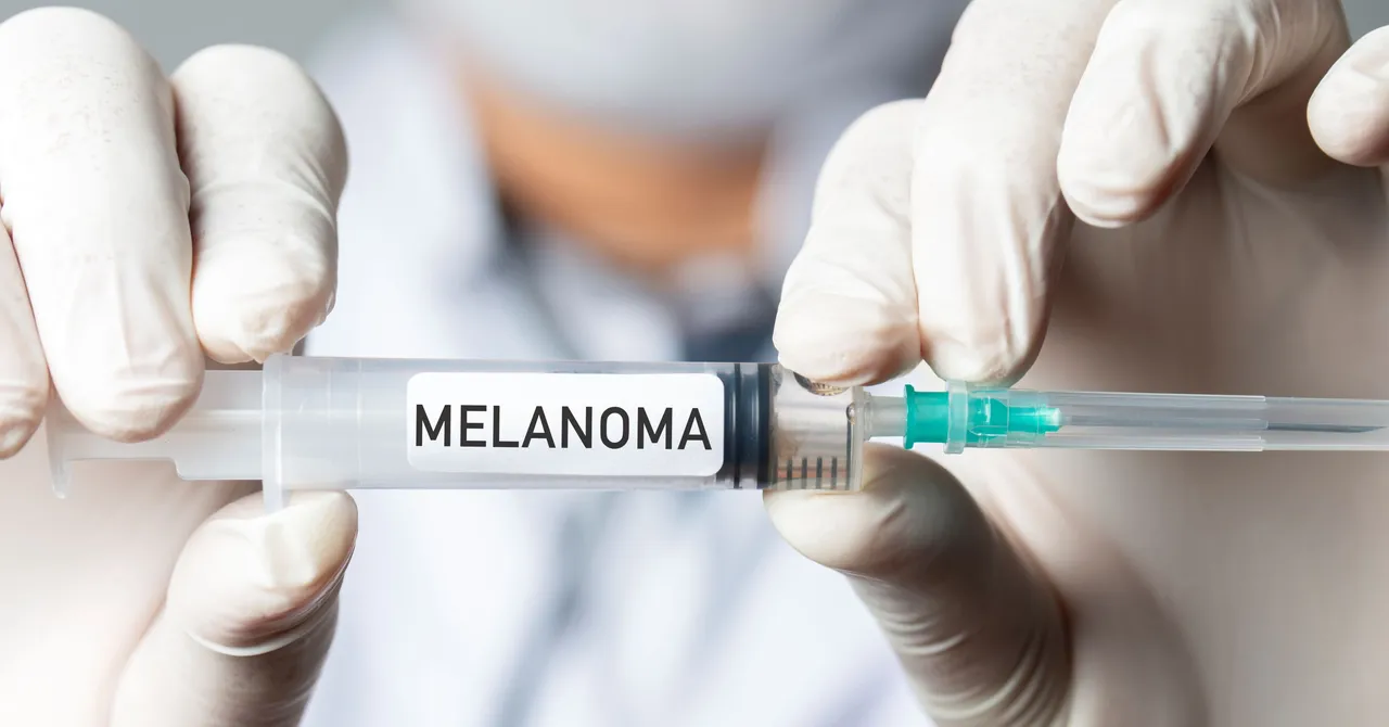 New mRNA Vaccine Reduces Risk of Melanoma Recurrence by Over 40 Percent