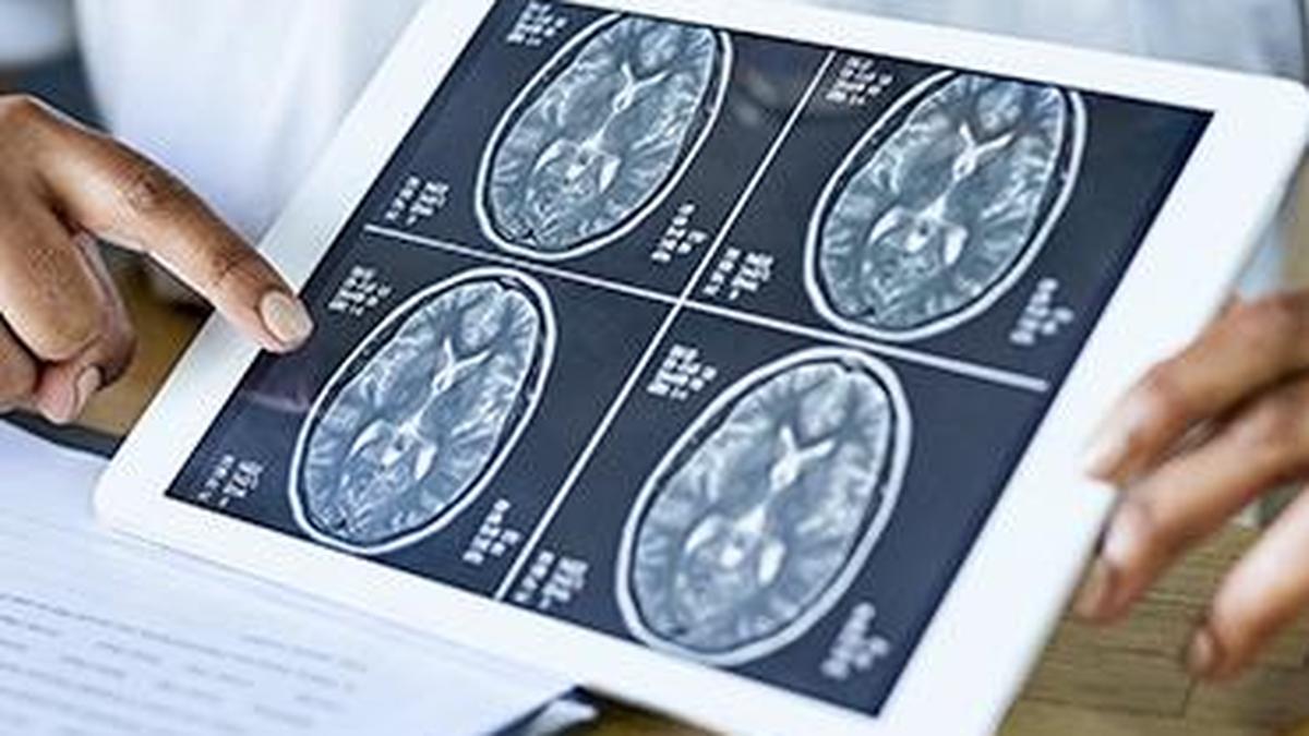 What happens inside the brain during a stroke?